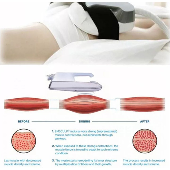 Funkcinis magnetinis stimuliatorius EMS 5 | Medisa.lt