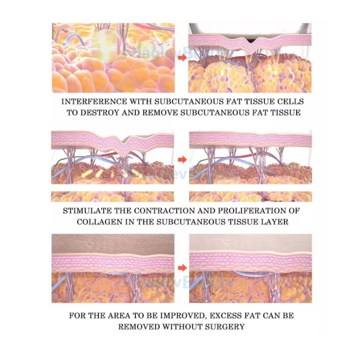 Velashape 3 Aparatas Mini 4in1 | Medisa.lt