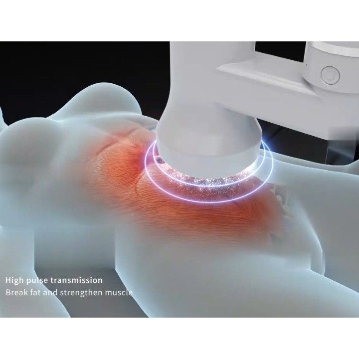 Robotas kūno formavimui EMS CRYO | Medisa.lt