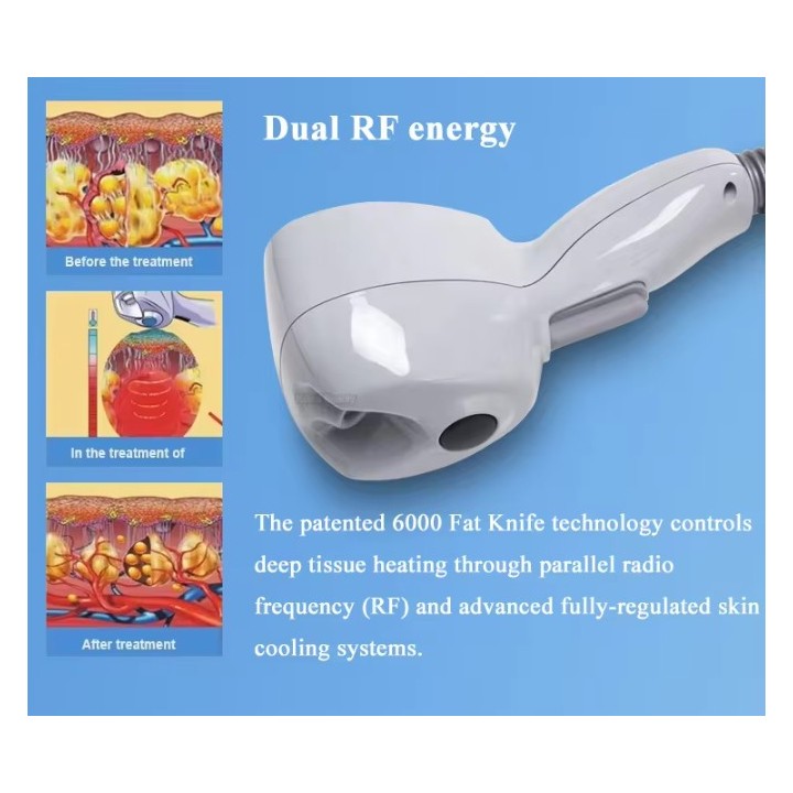 Exili ultra 360 RF veido liftingas kūno lieknėjimo | Medisa.lt