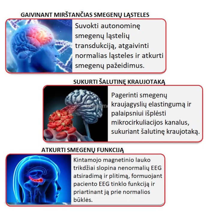 Smegenų terapijos įranga | Medisa.lt