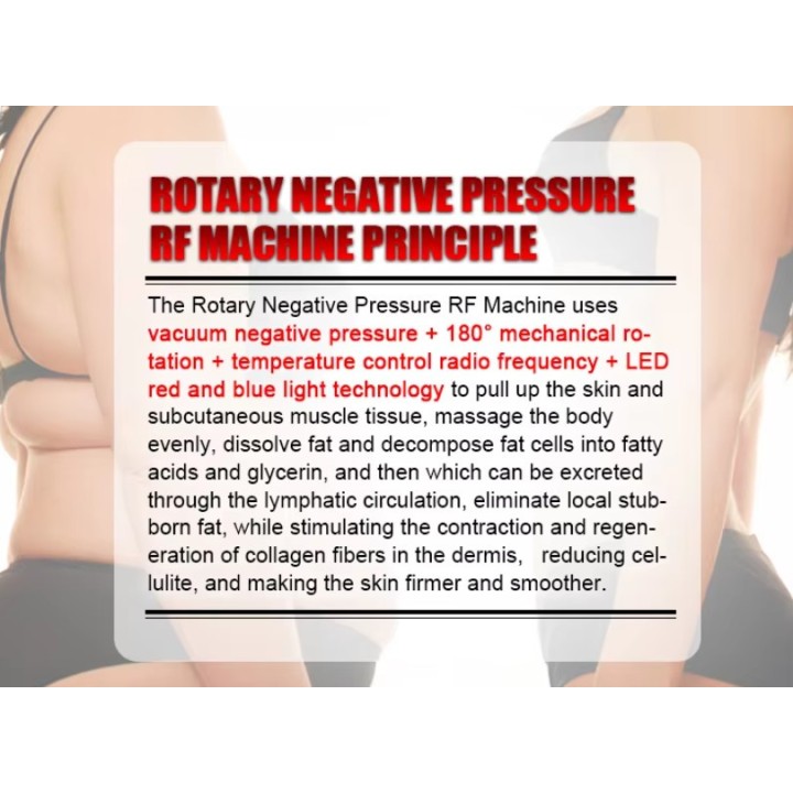 Velashape Vakuuminis RF lieknėjimo aparatas | Medisa.lt