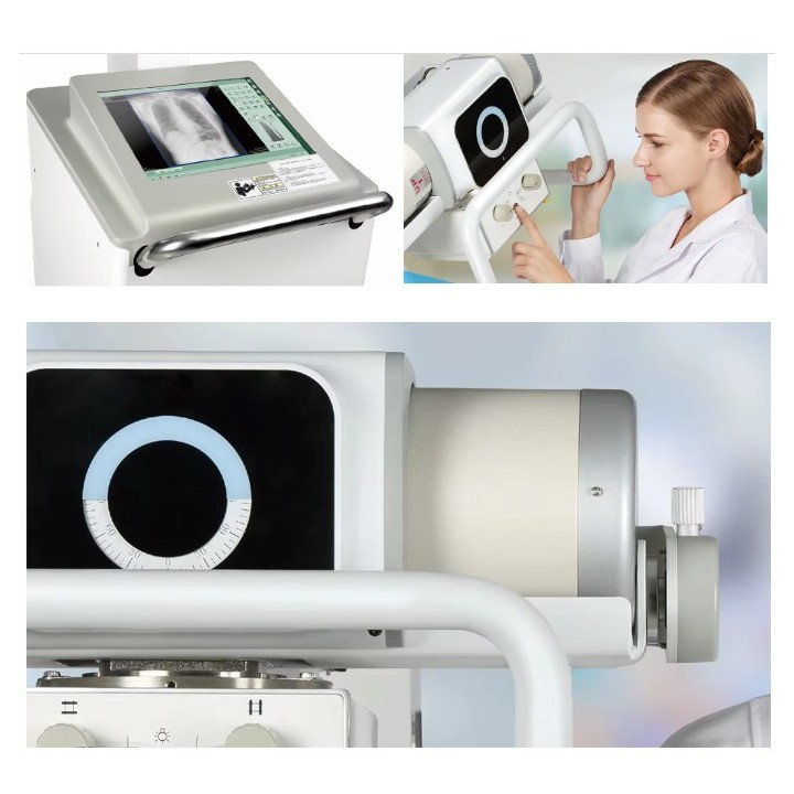 Mobilus medicininis rentgeno aparatas | Medisa.lt