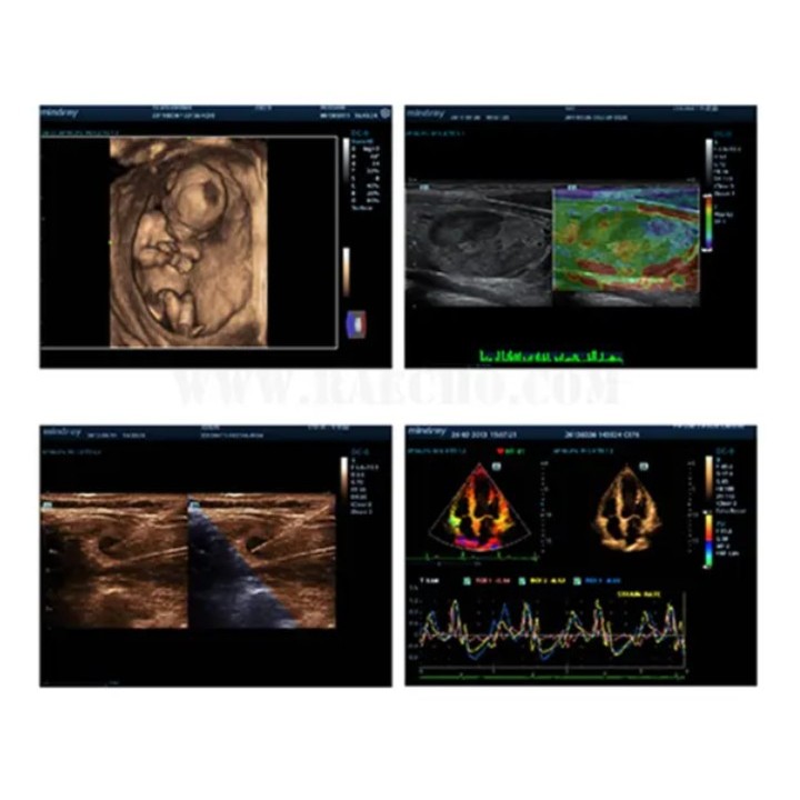 Doplerio ultragarso diagnostinis aparatas | Medisa.lt