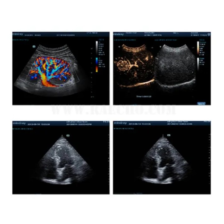 Doplerio ultragarso diagnostinis aparatas | Medisa.lt