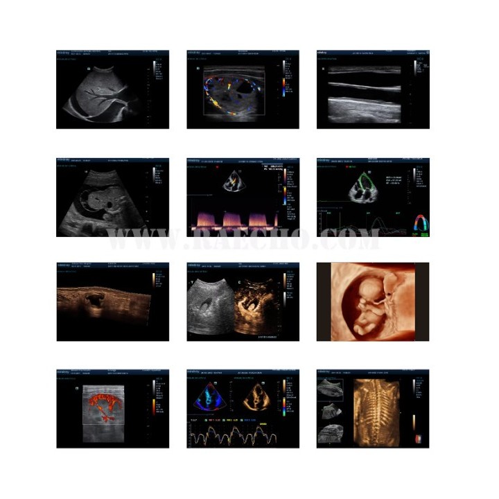 Doplerio ultragarso diagnostinis aparatas | Medisa.lt