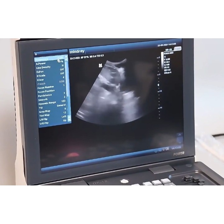 Mindray skaitmeninis ultragarso aparatas | Medisa.lt