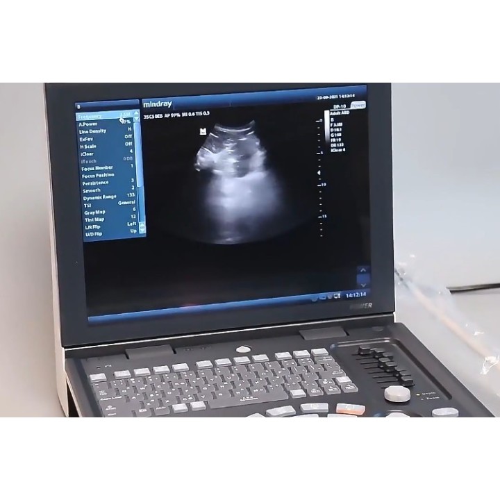 Mindray skaitmeninis ultragarso aparatas | Medisa.lt