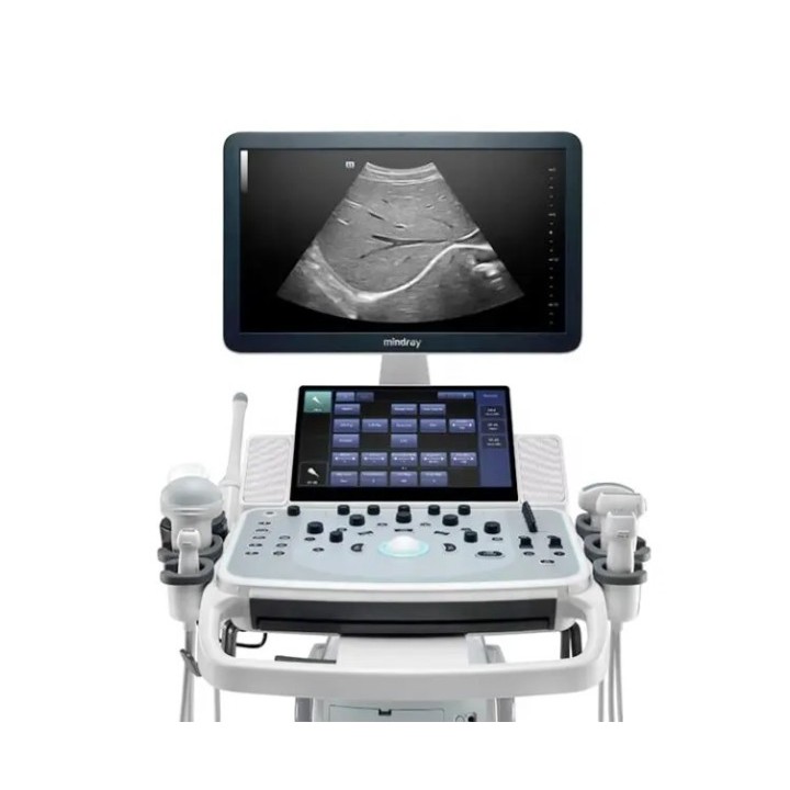 Mindray mobilioji ultragarsinė diagnostikos sistema | Medisa.lt