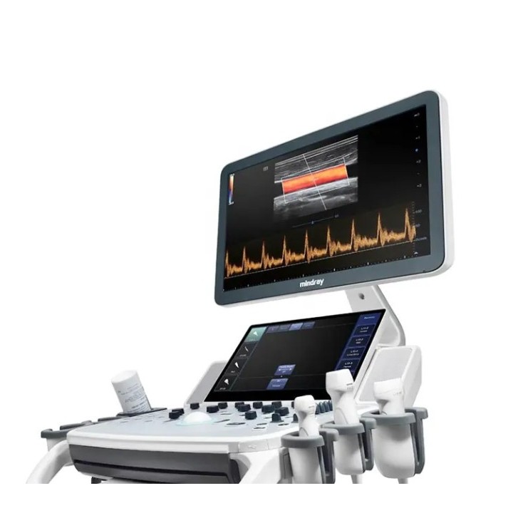 Mindray mobilioji ultragarsinė diagnostikos sistema | Medisa.lt