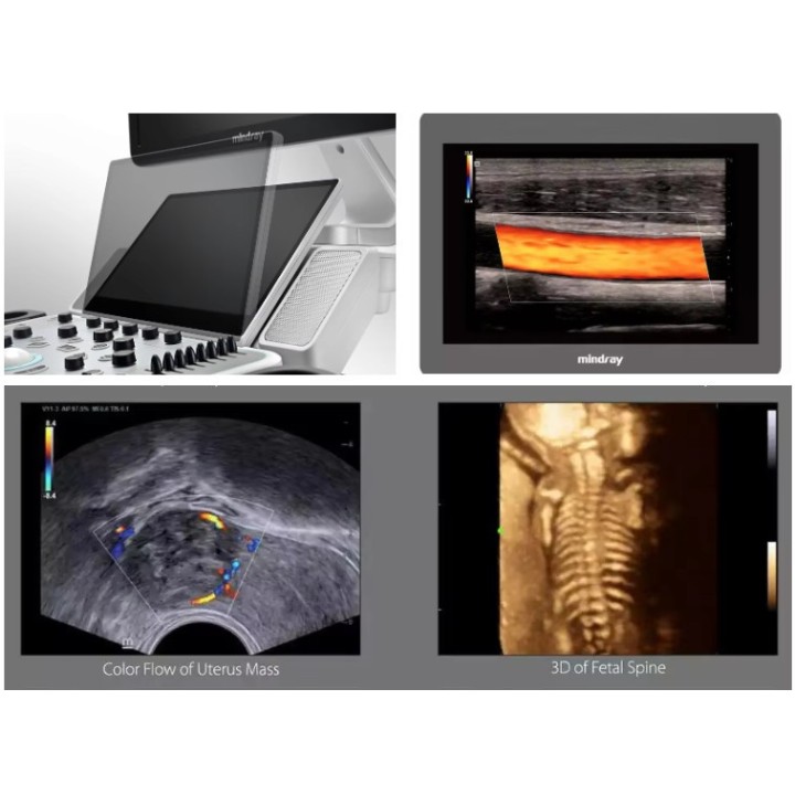 Mindray mobilioji ultragarsinė diagnostikos sistema | Medisa.lt