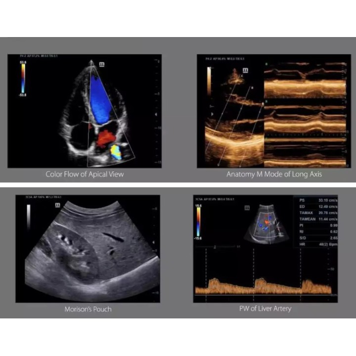 Mindray mobilioji ultragarsinė diagnostikos sistema | Medisa.lt