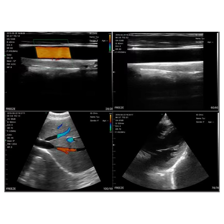 3 in 1 spalvotas Doplerio belaidis rankinis ultragarsinis | Medisa.lt