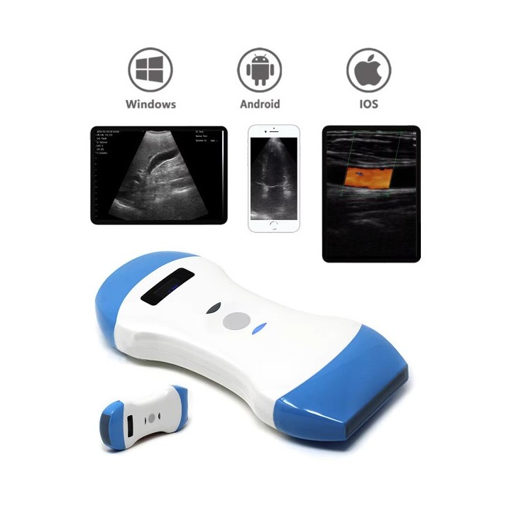 3 in 1 spalvotas Doplerio belaidis rankinis ultragarsinis | Medisa.lt
