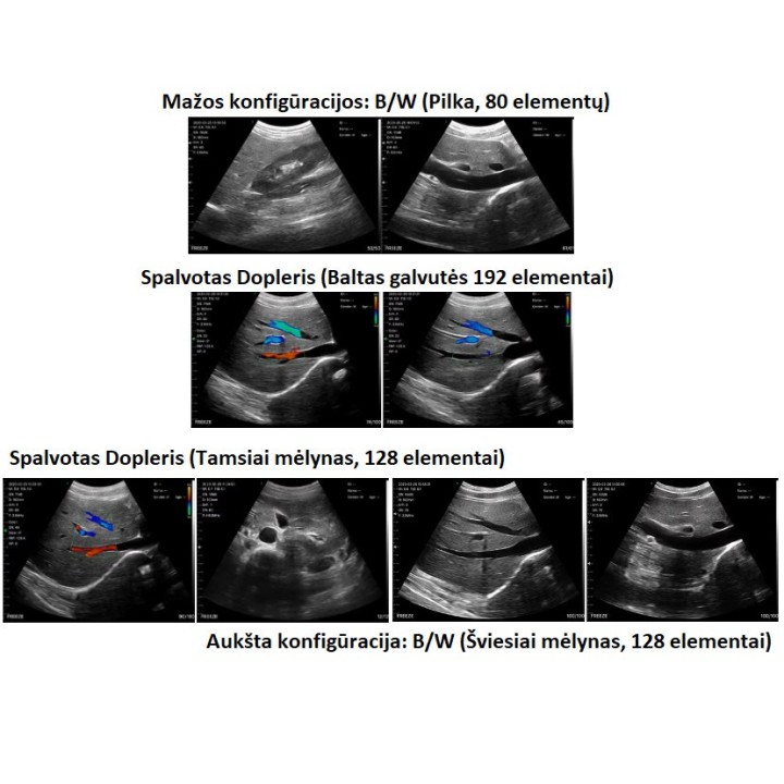 Skaitmeninis belaidis rankinis mini ultragarsinis | Medisa.lt