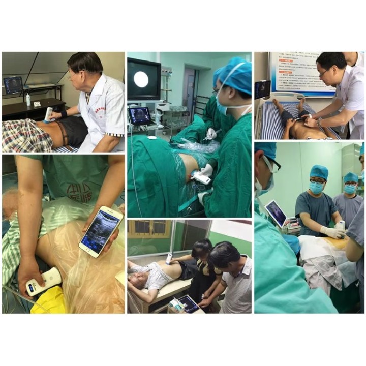 Skaitmeninis belaidis rankinis mini ultragarsinis | Medisa.lt