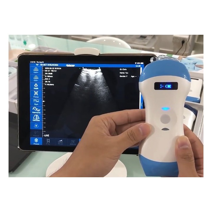 Skaitmeninis belaidis rankinis mini ultragarsinis | Medisa.lt