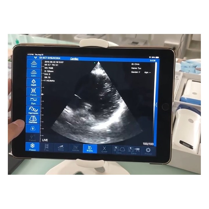 Skaitmeninis belaidis rankinis mini ultragarsinis | Medisa.lt