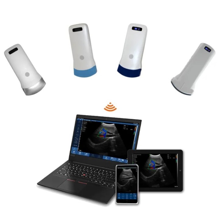 Skaitmeninis belaidis rankinis mini ultragarsinis | Medisa.lt