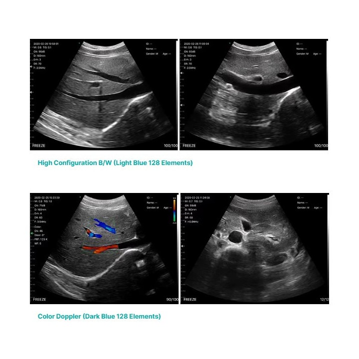 Skaitmeninis belaidis rankinis mini ultragarsinis | Medisa.lt