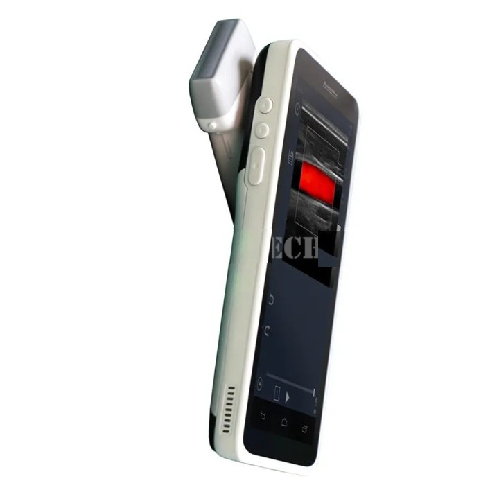 Ultragarsinis spalvotas Doplerio linijinis ultragarsinis | Medisa.lt
