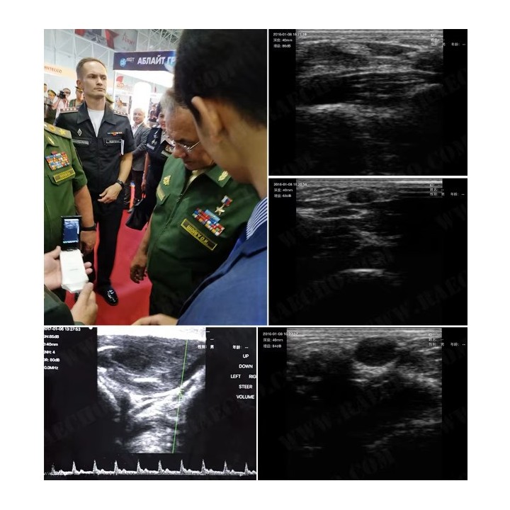 Ultragarsinis aparatas su belaidžiu jutikliu | Medisa.lt