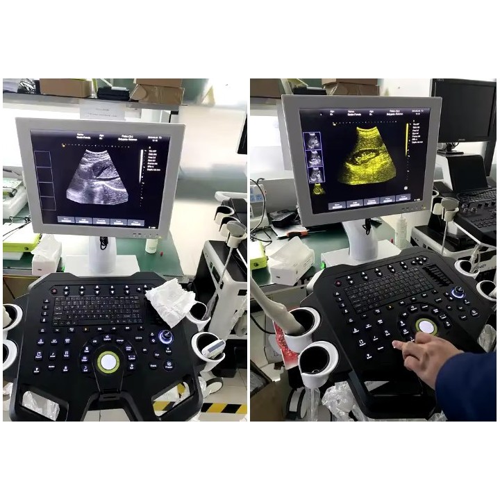 Ultragarsinis aparatas juodai baltas | Medisa.lt