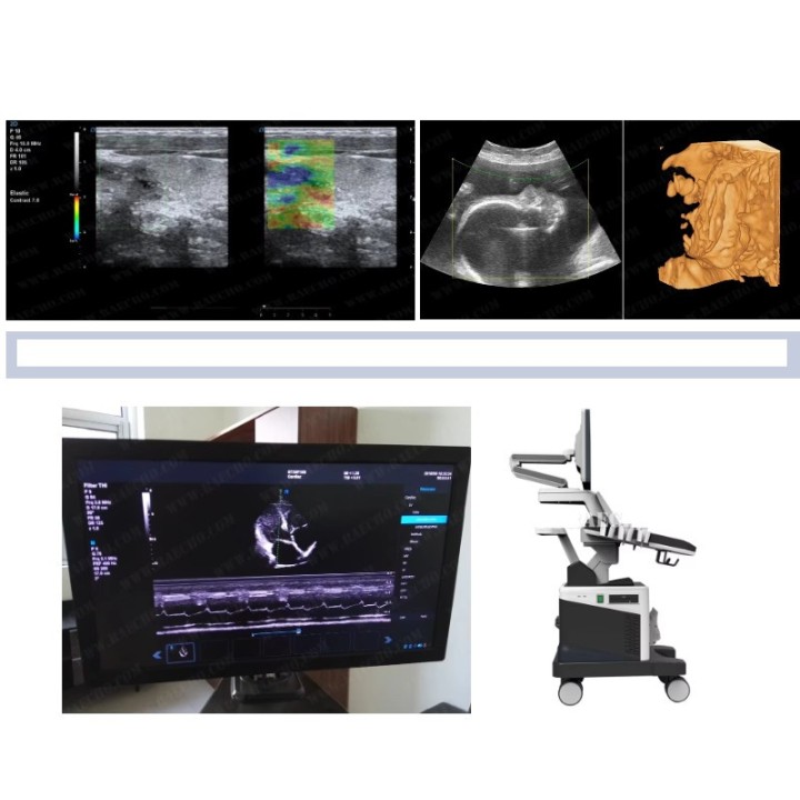 Doplerio ultragarso diagnostinis aparatas | Medisa.lt