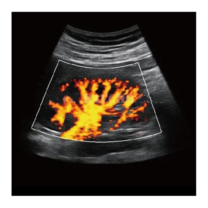 Ultragarso aparatas 4D | Medisa.lt