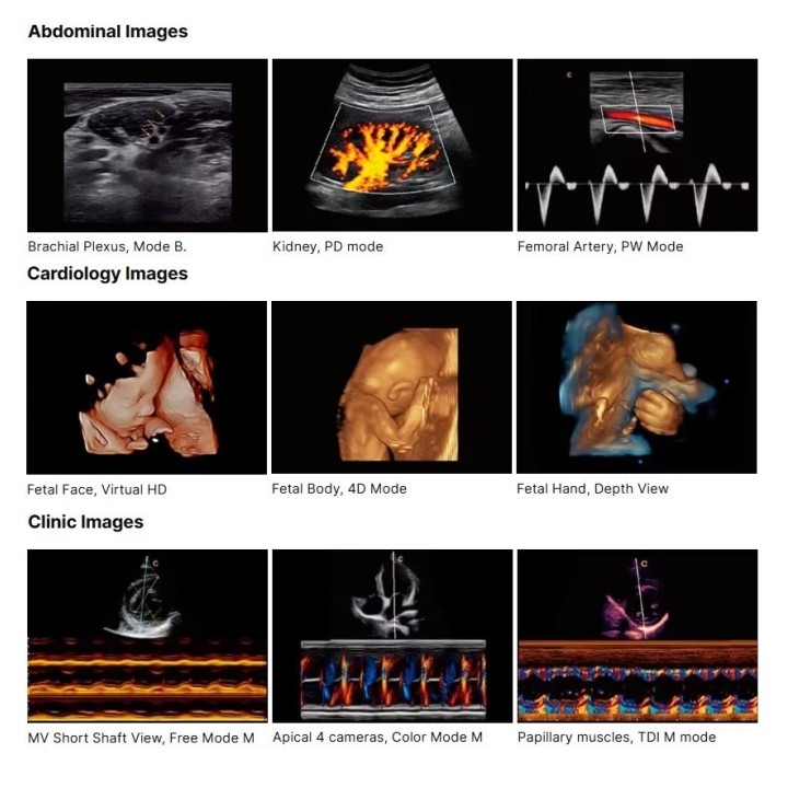 Ultragarso aparatas 4D | Medisa.lt