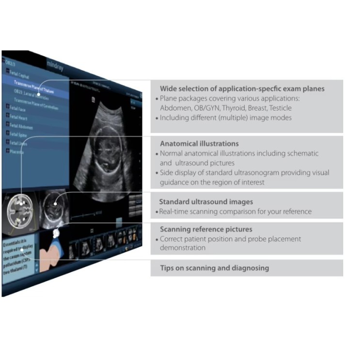 Mindray mobilioji ultragarsinė diagnostikos sistema | Medisa.lt