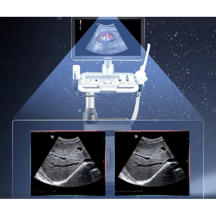 Mindray skaitmeninis ultragarso aparatas | Medisa.lt