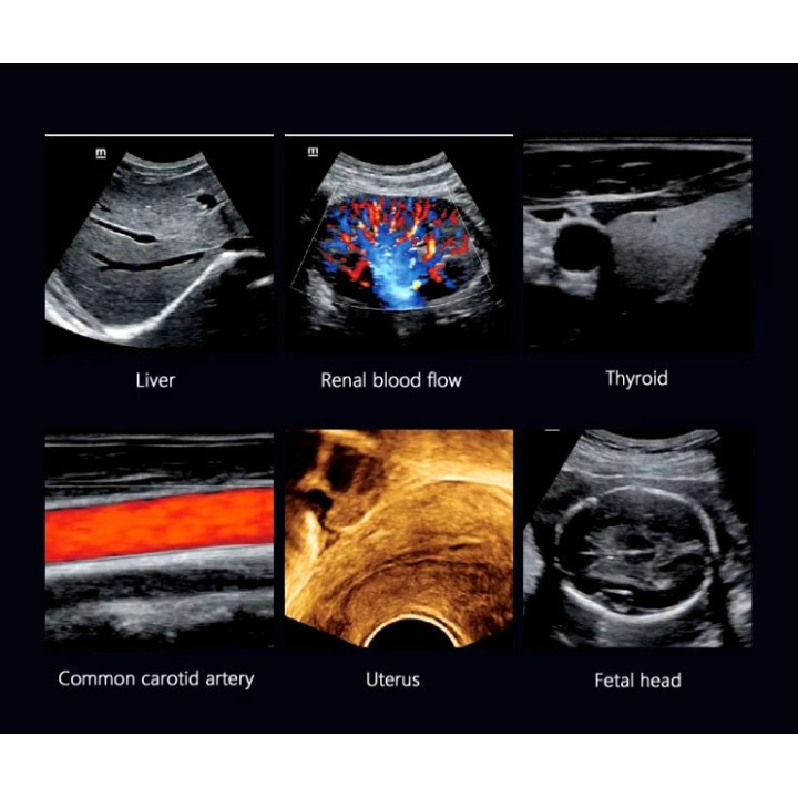 Mindray skaitmeninis ultragarso aparatas | Medisa.lt