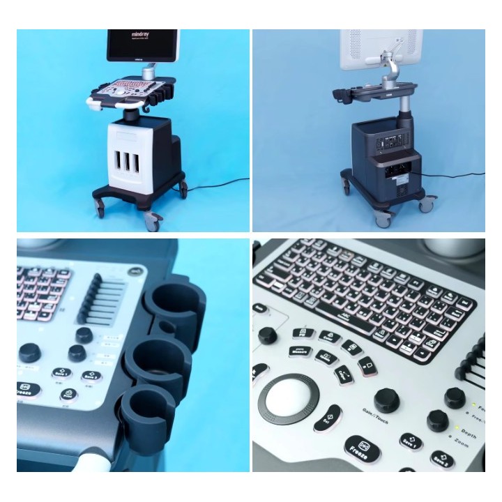 Mindray skaitmeninis ultragarso aparatas | Medisa.lt