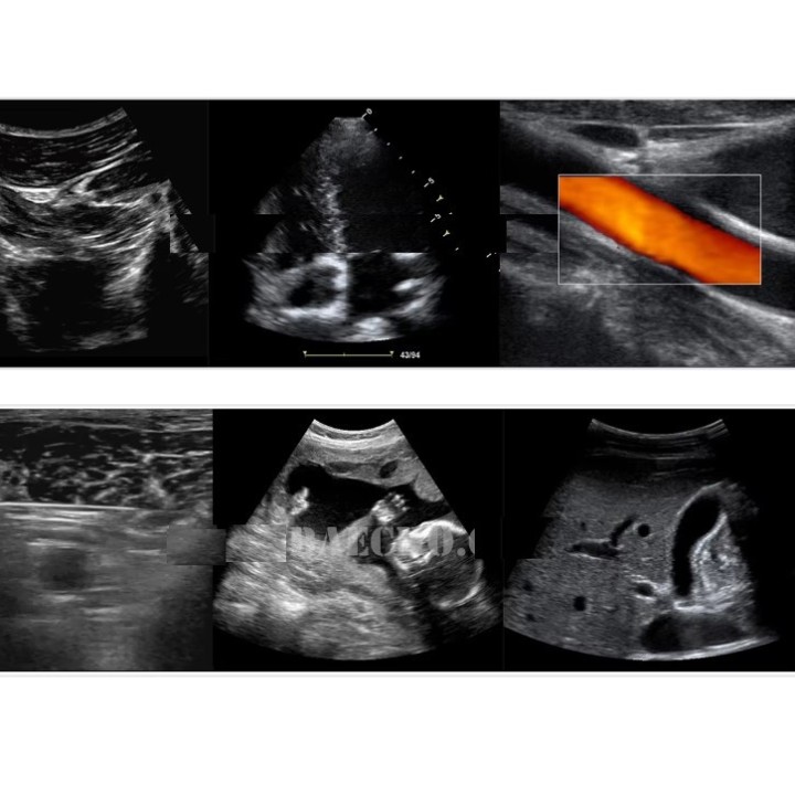 Ultragarso aparatas anestezijai | Medisa.lt