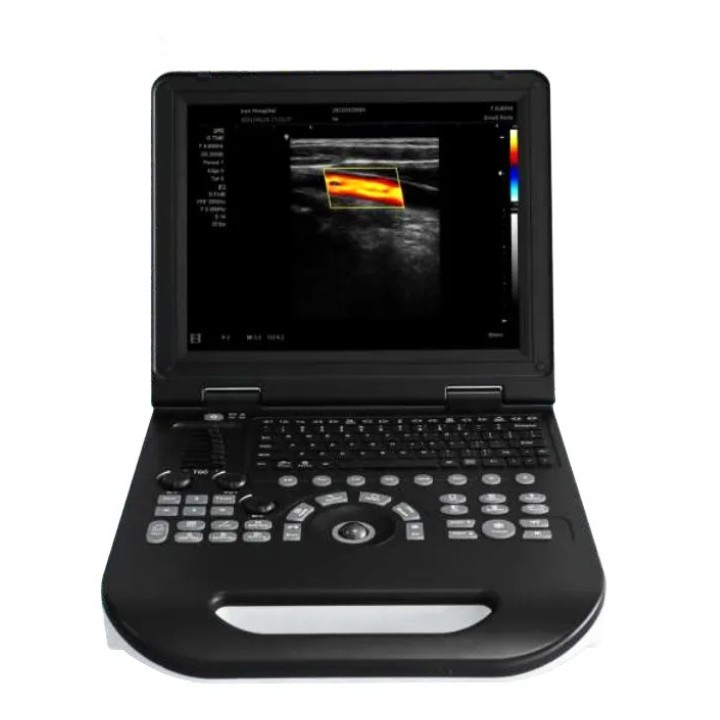 Doplerio ultragarso aparatas spalvotas | Medisa.lt