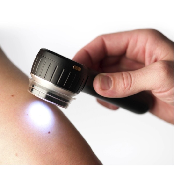 Dermatoskopas su poliarizuota ir nepoliarizuota šviesa | Medisa.lt