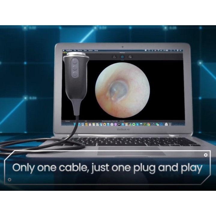 FullHD endoskopinė kamera UC-100 | Medisa.lt
