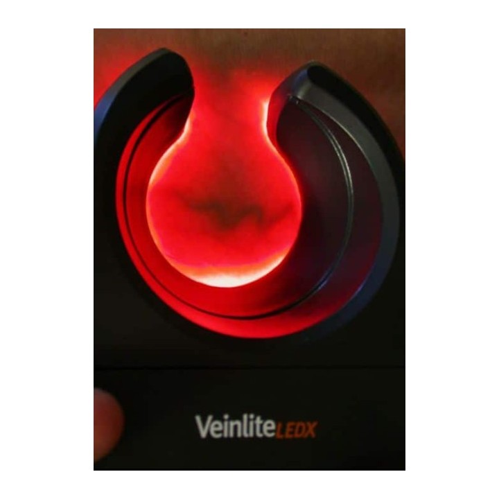 LEDX Veinlite kraujagyslių apšvietimas | Medisa.lt