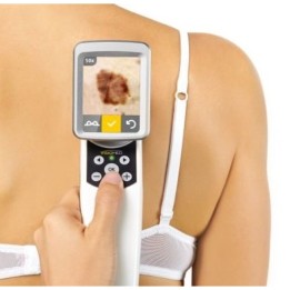 Videodermatoskopas | Medisa.lt
