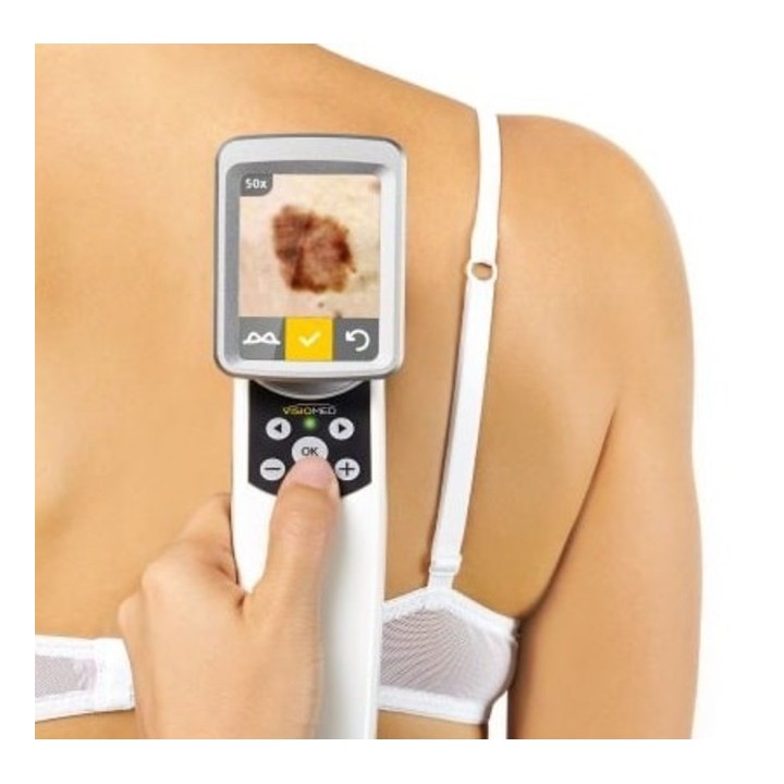 Videodermatoskopas | Medisa.lt