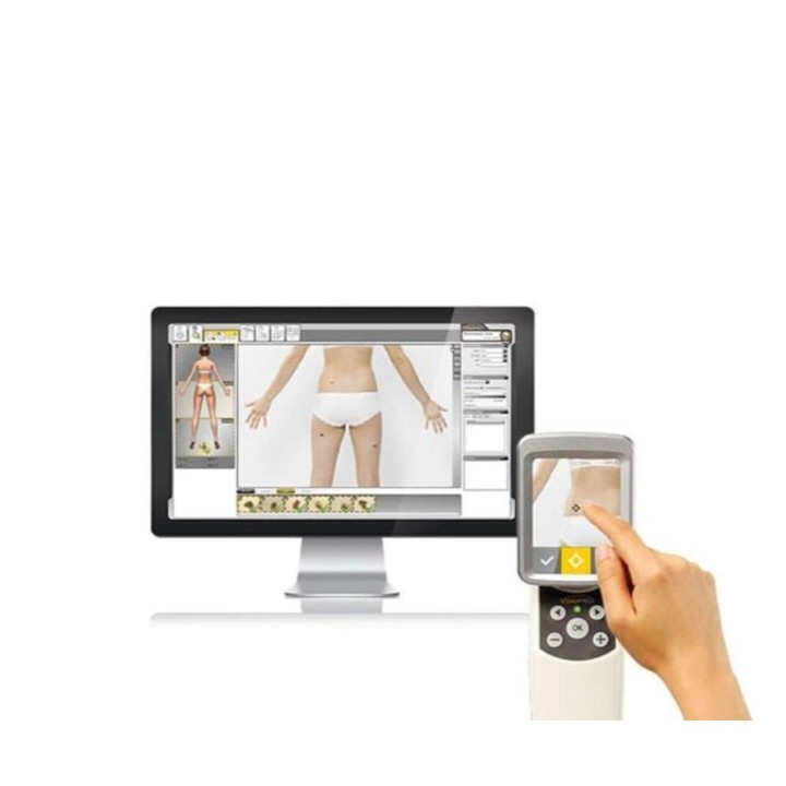 Videodermatoskopas | Medisa.lt