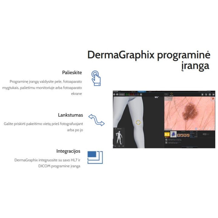 Videodermatoskopas | Medisa.lt