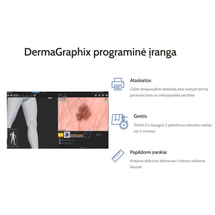 Videodermatoskopas | Medisa.lt