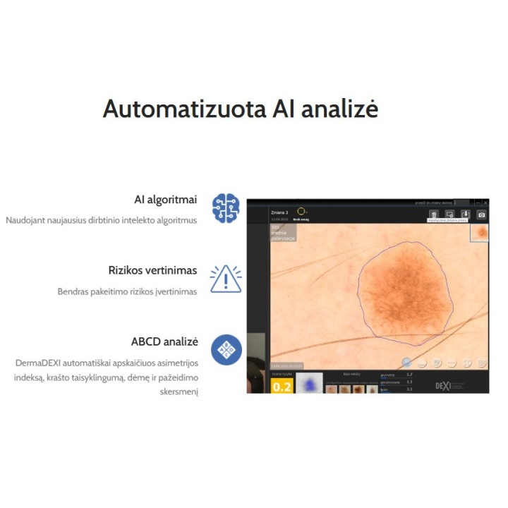 Videodermatoskopas | Medisa.lt