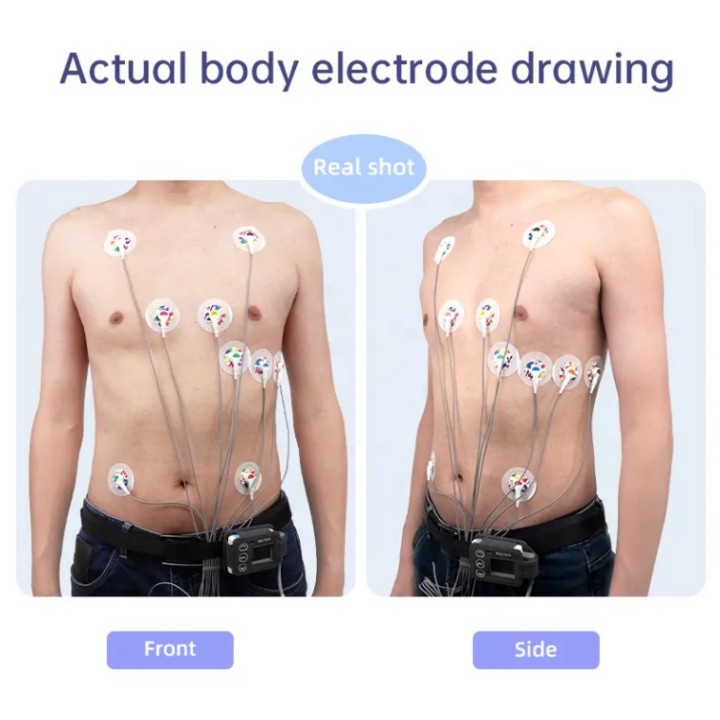 EKG holteris | Medisa.lt
