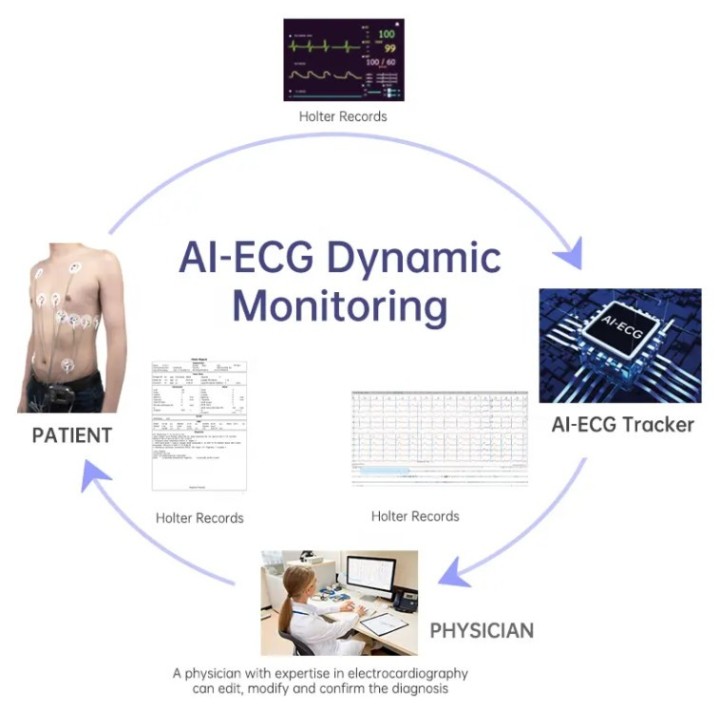 EKG holteris | Medisa.lt