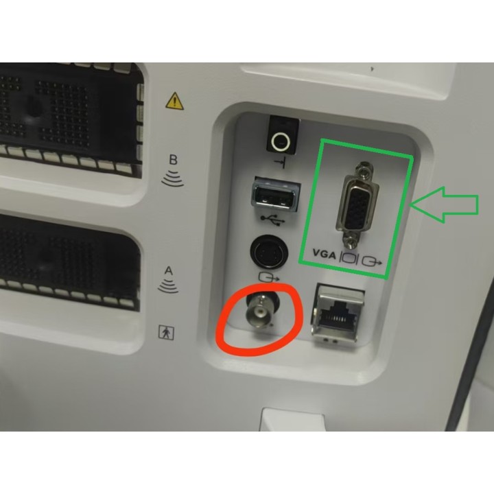 Mindray skaitmeninis ultragarso aparatas | Medisa.lt