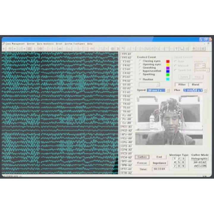 EEG 32 kanalų skaitmeninis elektroencefalografas | Medisa.lt