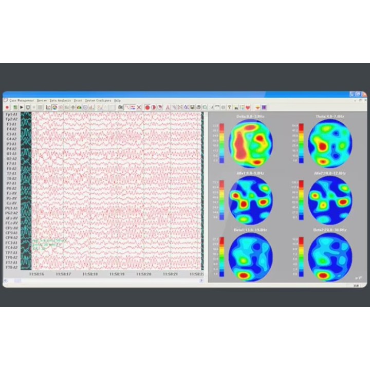 EEG 32 kanalų skaitmeninis elektroencefalografas | Medisa.lt